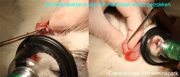 De melkhoektand van de onderkaak wordt getrokken